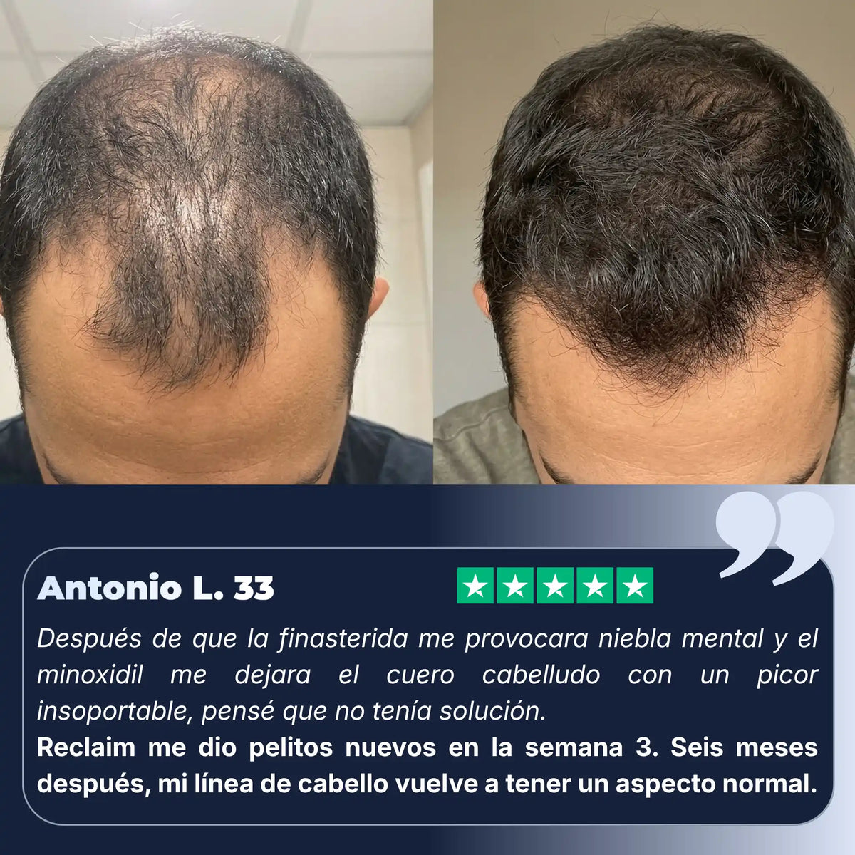 Serum Reclaim